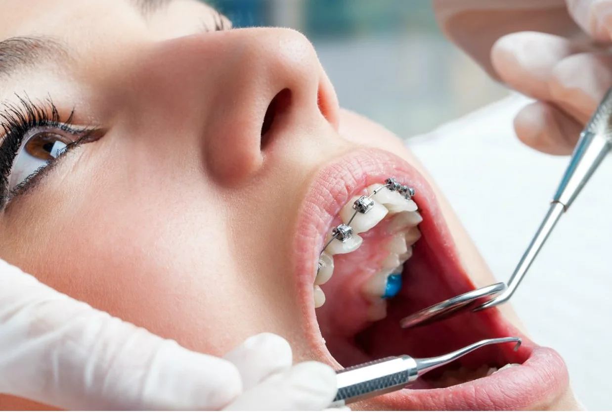 Orthodontics