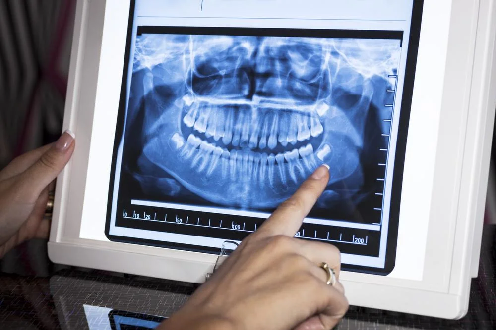 Digital X-Ray
